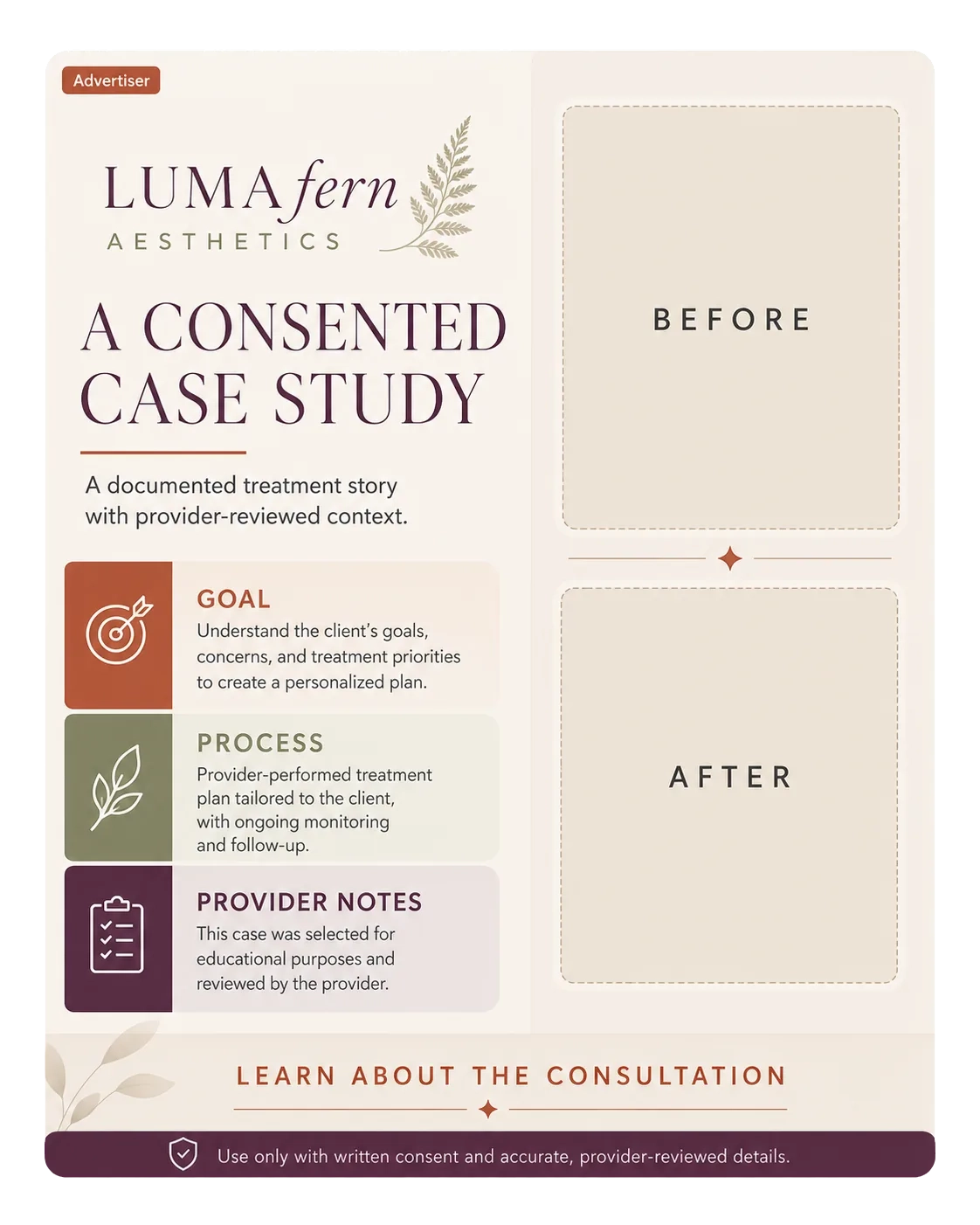 Consented case-study template: a documented treatment story with provider-reviewed context; goal, process, provider notes; the before and after panels left empty, used only with written consent; learn about the consultation.